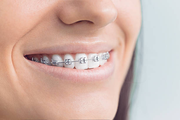 Best Invisalign and Clear Aligners  in Wyoming, PA